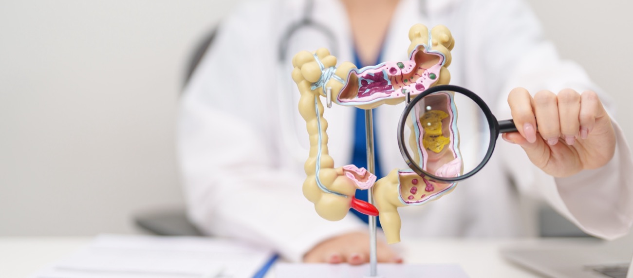 Doctor holding a magnifying glass on a colon model